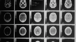 AI医疗影像发展趋势研究